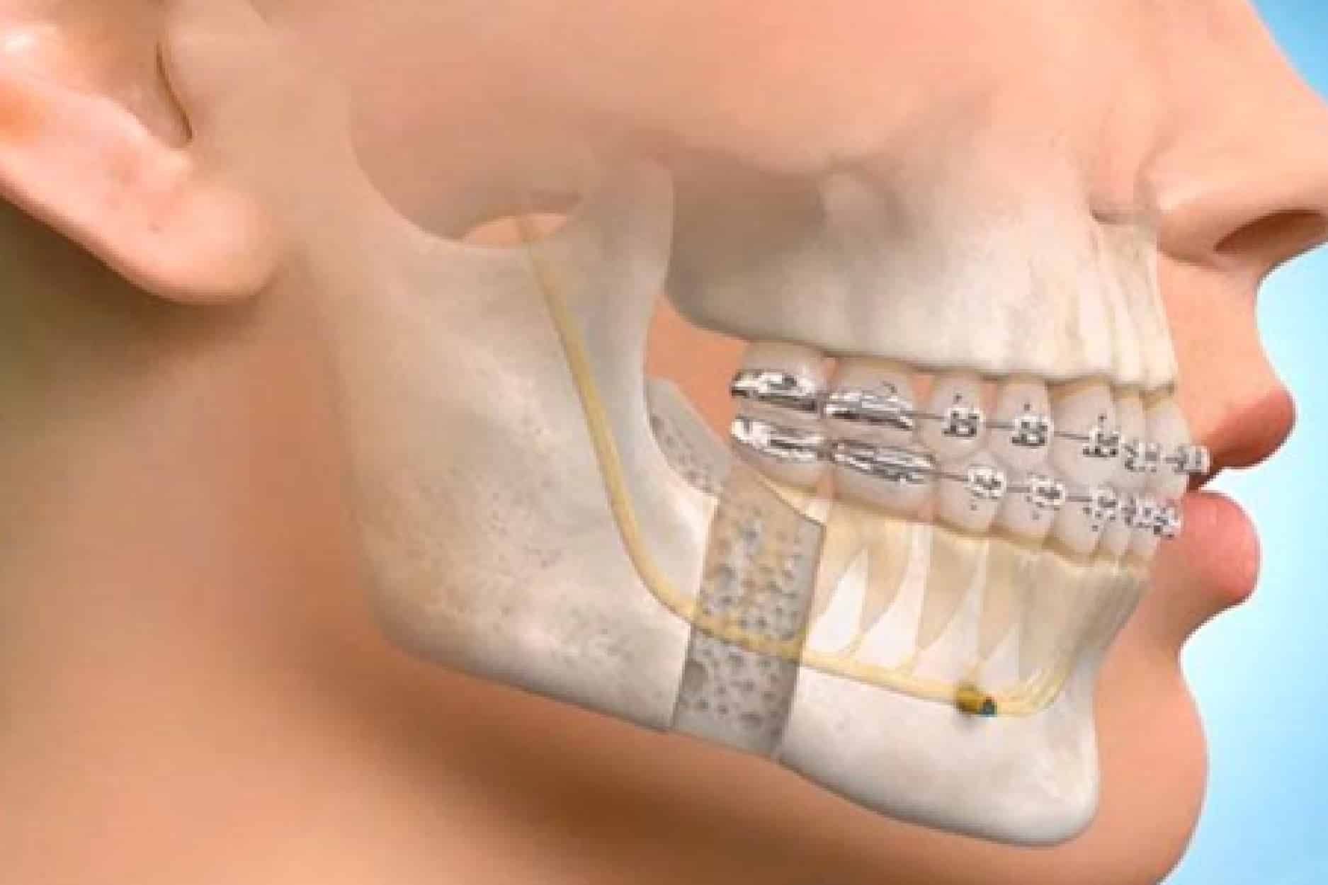 Oral And Maxillofacial Surgery Turkey Periodonta